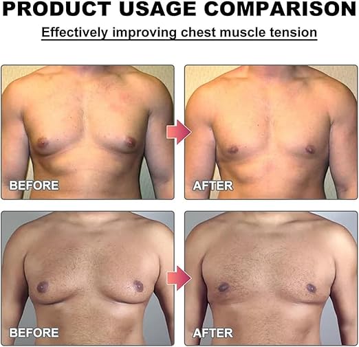 Men Therm - Bee Venom Gynecomastia Heating Oil 2