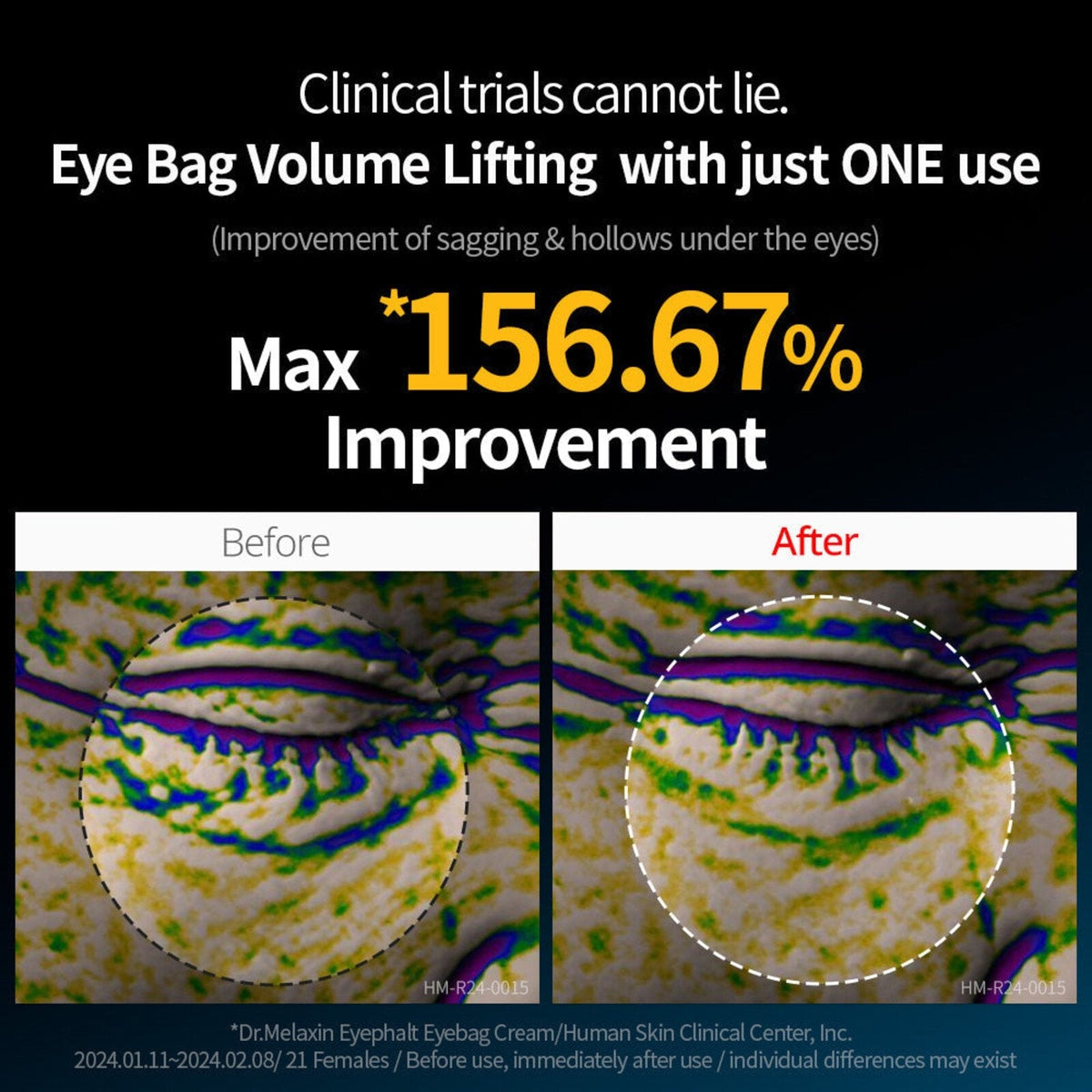 Dr Melaxin - Eyephalt Eyecream 4