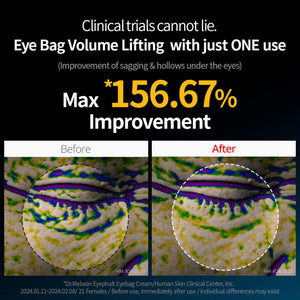 Dr Melaxin - Eyephalt Eyecream 4