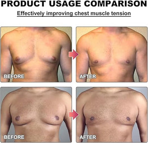 Men Therm - Bee Venom Gynecomastia Heating Oil 2